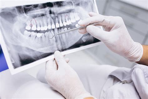 radiografia odontologica